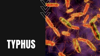 Wat is tyfus? Symptomen, verspreiding en onderdrukking
