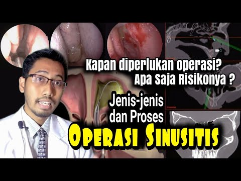 , title : 'Penjelasan Jenis-jenis dan Proses Operasi Sinusitis, Kenapa Diperlukan Operasi, Apa Risikonya'