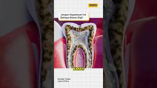Download lagu Tooth Abscess: A Small Infection That Can Be Fatal! mp3 Download lagu Tooth Abscess: A Small Infection That Can Be Fatal! mp3