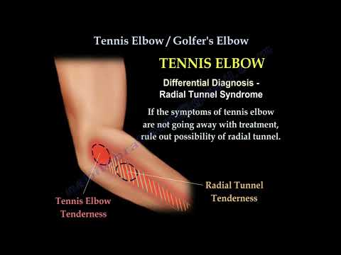 Łokieć tenisisty - anatomia i leczenie