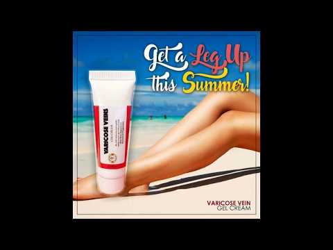 varicoza vânatai