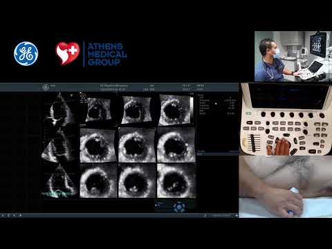 4D tutorials: 1. How to acquire 4D views of left ventricle