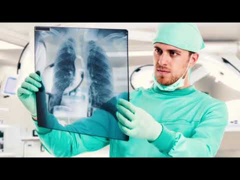 Cancer pulmonar articulos