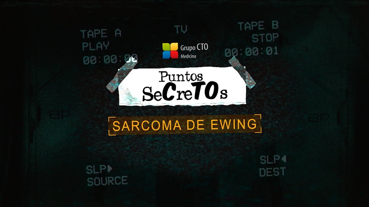 Puntos SeCreTOs - Sarcoma de Ewing