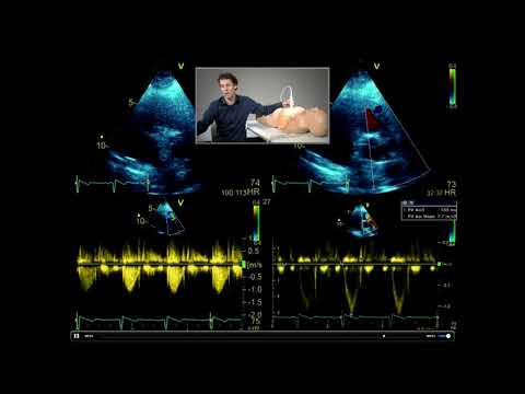 How to perform a full, comprehensive transthoracic echo study