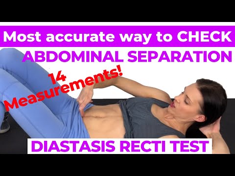 Best Exercises for Diastasis Recti Postpartum Ab Workout