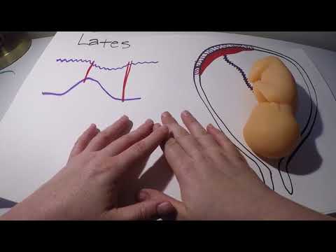 Fetal Decelerations