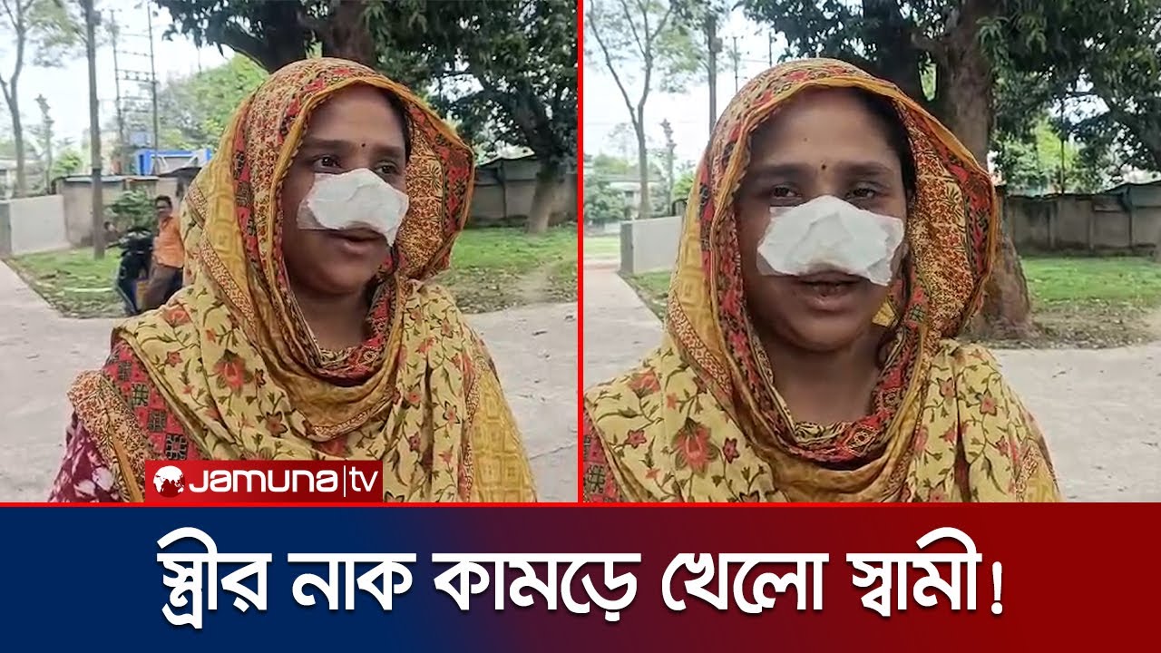 নদীয়ায় নাক সুন্দর হওয়ায় স্ত্রীর নাক কামড়ে ক্ষত করলো স্বামী! | India | West Bengle | Jamuna TV