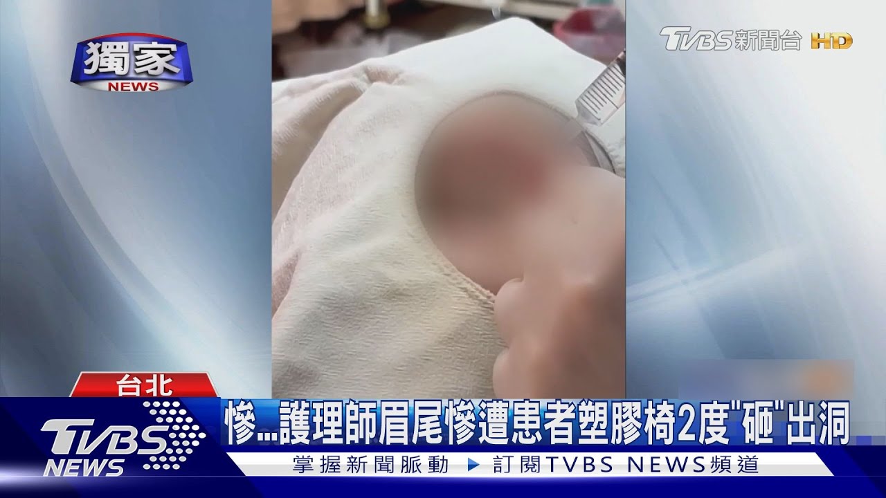 慘！護理師眉尾慘遭患者塑膠椅2度「砸」出洞