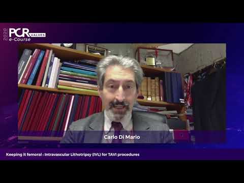 Keeping it femoral: Intravascular Lithotripsy (IVL) for TAVI procedures - PCR Valves e-Course 2020