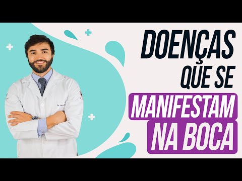 Diseases that manifest in the mouth and you don't even suspect