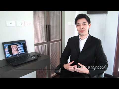 การผ่าตัดแก้ไขเต้านม Seroma ในหน้าอกหลังจาก PLASTY