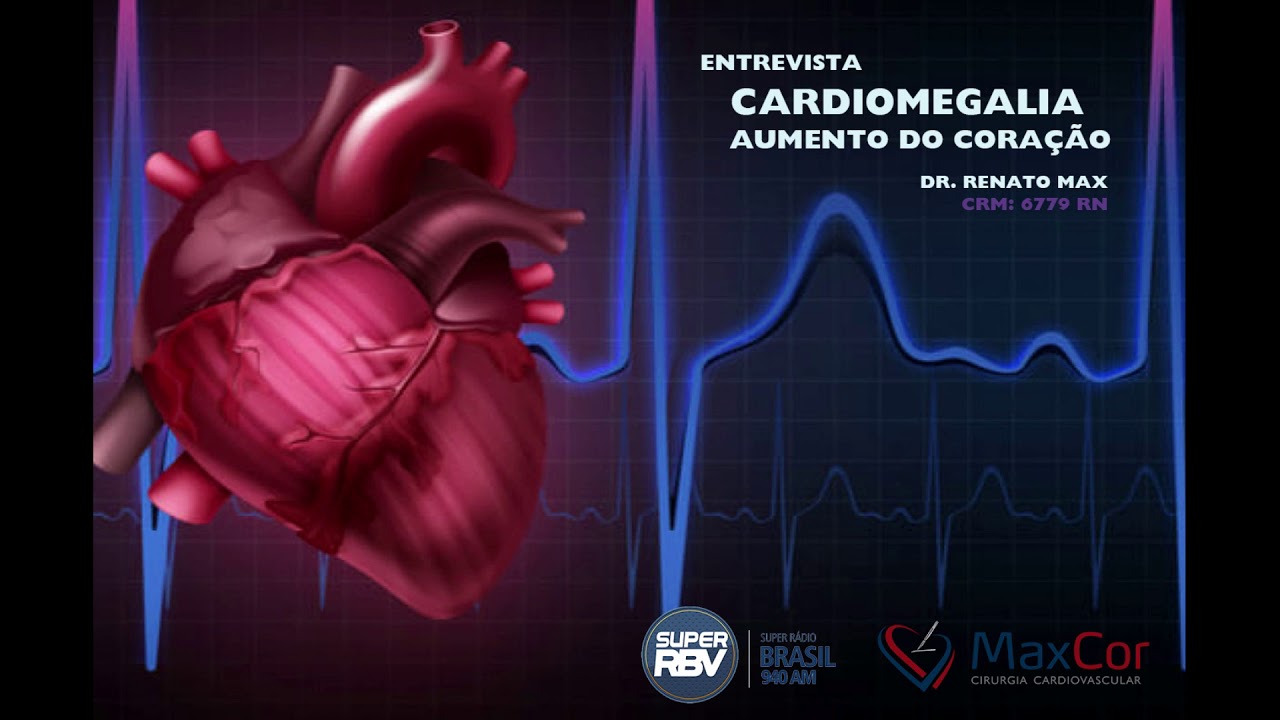 Renato Max-96