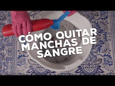FAB: ¿Cómo quitar una mancha de sangre con Fabiola S.O.S?