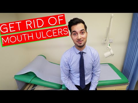 Canker Sores | How To Get Rid Of Canker Sores | Mouth Ulcer Treatment