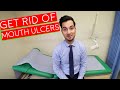 Canker Sores | How To Get Rid Of Canker Sores | Mouth Ulcer Treatment Canker Sores | How To Get Rid Of Canker Sores | Mouth Ulcer Treatment
