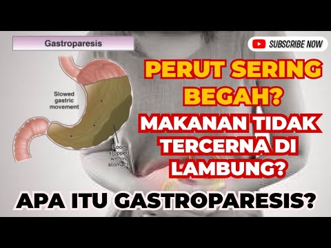 FREQUENTLY BLOATED FROM UNCENTERED FOOD? YOU MAY HAVE GASTROPARESIS!