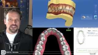 Digital Enamel - DE In 3 Cerec Ortho