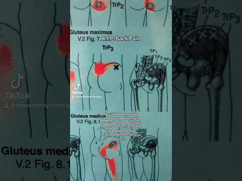 Back pain therapy using glutes (restoring pelvis and femur function)