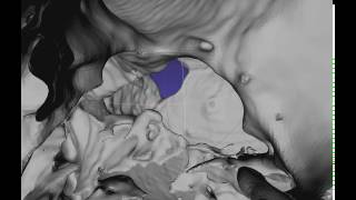 Phineas Gage Tamping Iron Path