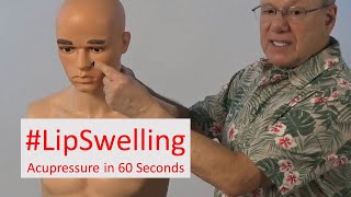 Acupressure Technique to Reduce Lip Swelling