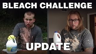 ☠️ The (Original) BLEACH CHALLENGE, Where Are They Now? - LIVE EASY: Going Viral
