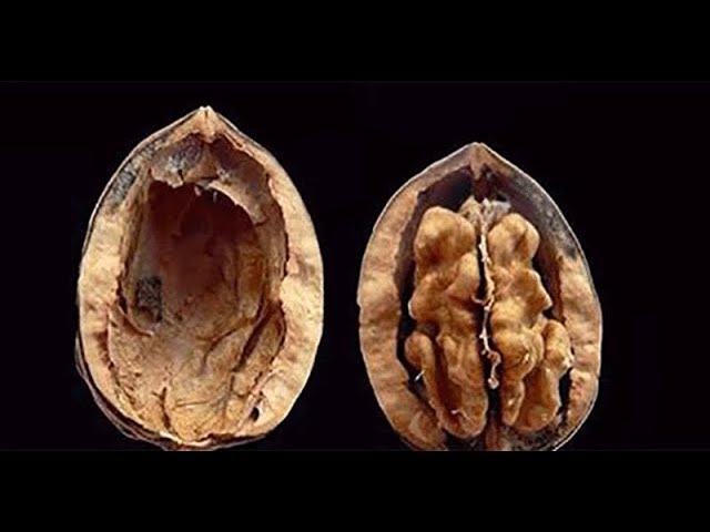 Video Pronunciation of phytic acid in English Video Pronunciation of phytic acid in English