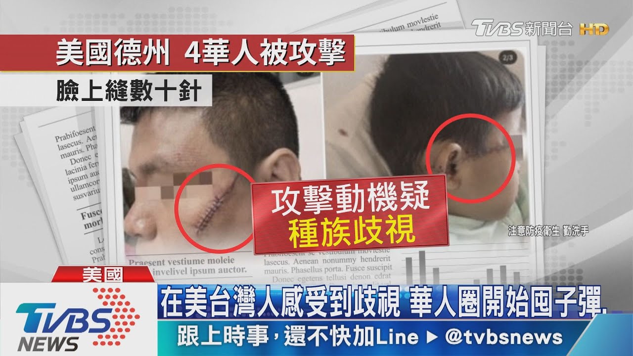 在美台灣人感受到歧視 華人圈開始囤子彈