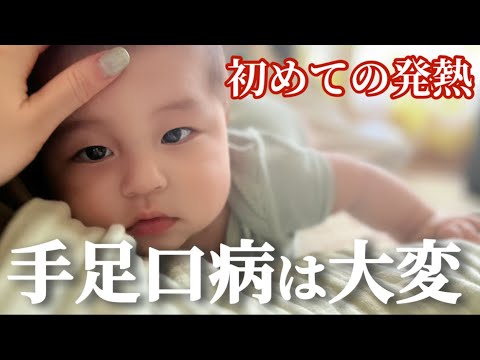 【ハーフ生後6ヵ月】手足口病の2週間の経過についてまとめました💦家族で発熱で大変な1ヵ月でした🥹/離乳食開始のためにハイチェア購入