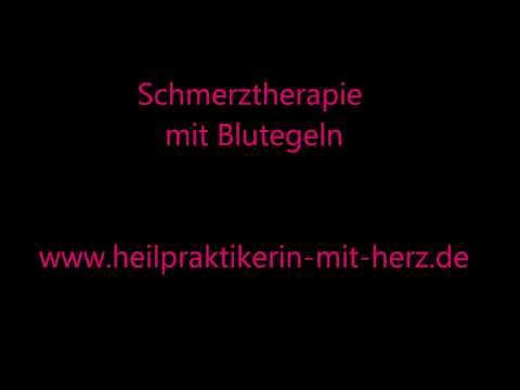 Osteochondrose einer zervikalen Abteilung Schulter Tabelle von Erkrankungen der Gelenke