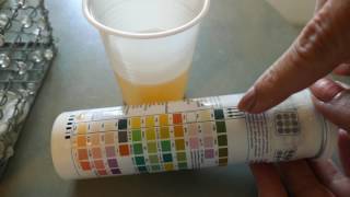 Come fare e come leggere lo stick delle urine
