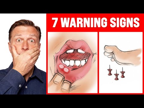 The 7 WARNING Signs of a B12 Deficiency - Dr. Berg