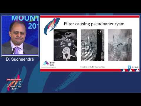 Hatch D2 - IVC Filters; Complications - Dr. Deepak Sudheendra
