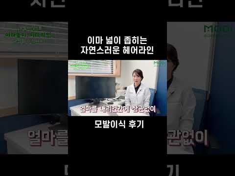 대평양 이마 주목!! 넓은 이마 좁히는 헤어라인 모발이식 후기 #숏츠