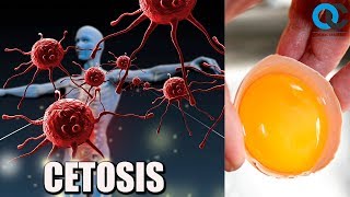 Dieta cetogénica explicada (Cetosis) 1º Parte
