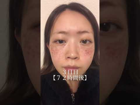 無数の女性には奇妙なそばかすが共通している - それは珍しい場所にある
