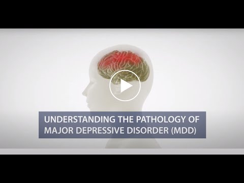 Understanding Disease Pathology of Major Depressive Disorders