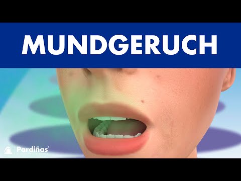 Mundgeruch ©