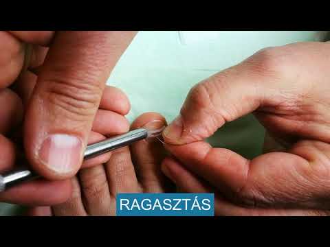 vásárol astin ízületi balzsamot az ízületek deformáló artrózisának hatékony kezelése