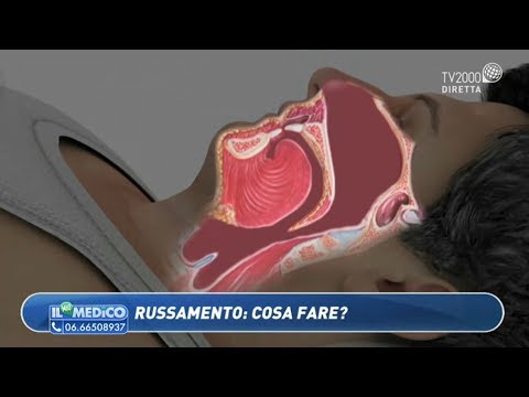 Il Mio Medico - Russamento: cosa fare?