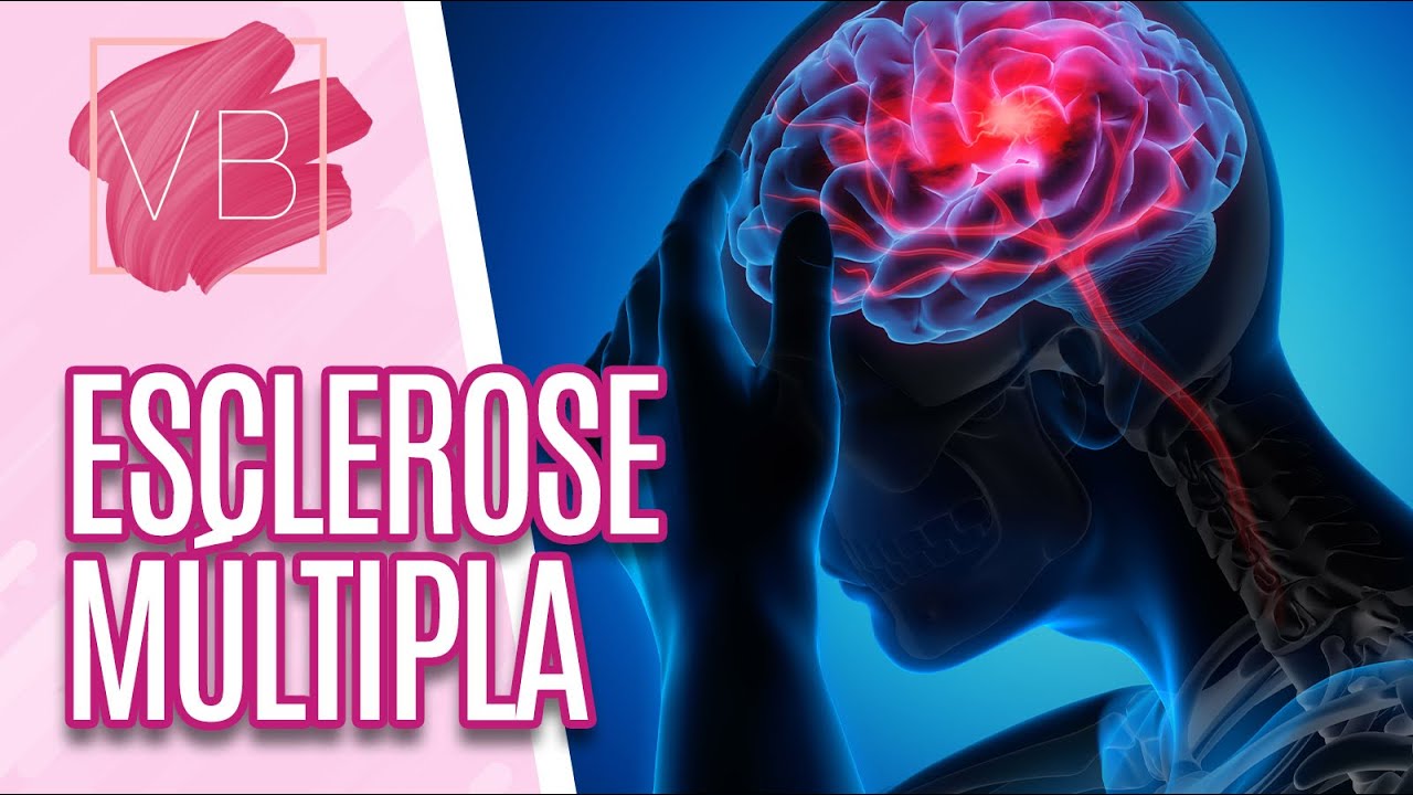Saiba mais sobre a esclerose múltipla, seus sintomas e tratamentos - Você Bonita (31/08/20)