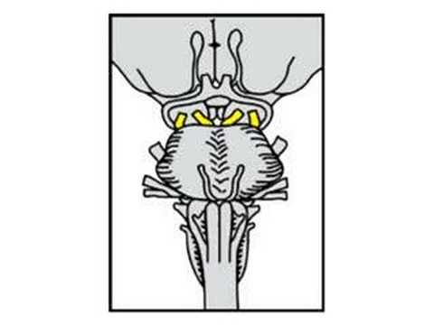 Cranial Nerve III and IV 4/16