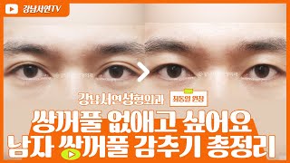 성형탐구 I 쌍꺼풀 없애기 총정리 l 수술방법, 전후사진, Q&A까지