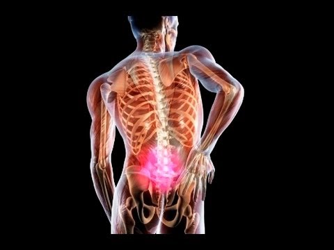 Грудные и спине боли при кашле Острые боли в спине видео