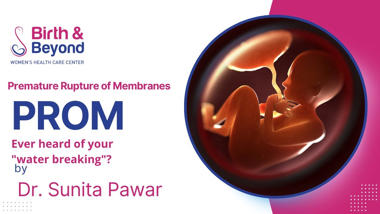 PROM: What You Need to Know