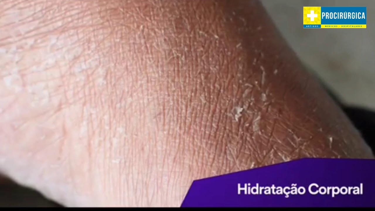 Cavilon™ Película Protetora 3M™ Creme de Barreira Durável Protetor da Pele 🔝🔝🔝