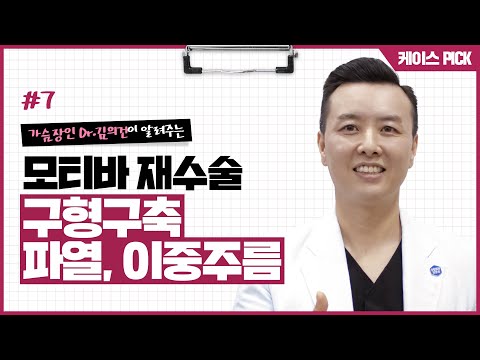 [가슴 재수술] 구형구축, 파열, 이중주름 가슴 성형 재수술 CASE | 윈느성형외과 라벨윈느 유튜브 영상
