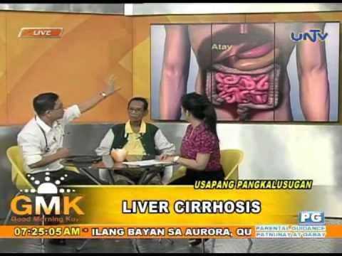 Mawalan ng timbang pagkatapos mirtazapine Simpleng recipe para sa pagkawala timbang