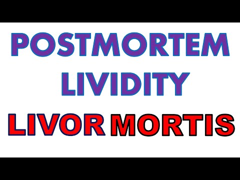 Postmortem Lividity | Livor Mortis | Forensic Medicine | Dr Krup Vasavda