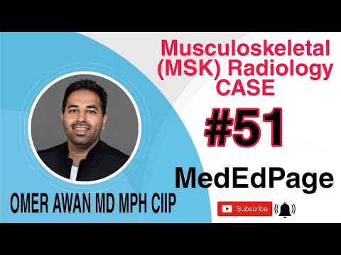 Musculoskeletal (MSK) Radiology CASE #51